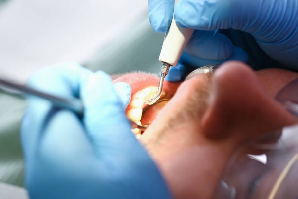 Best Urgent Dental Care for Toothaches in Brenham, TX
