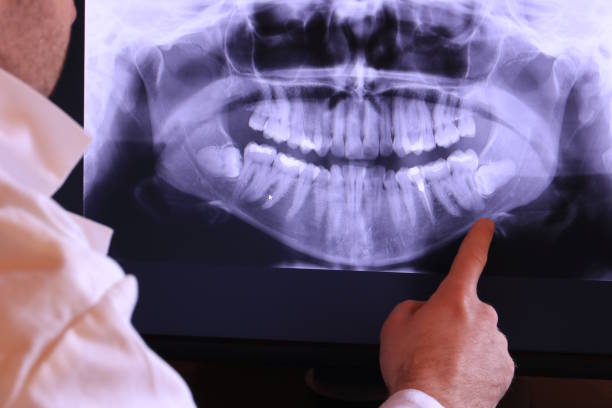 Best Emergency Treatment for Oral Infections in Brenham, TX